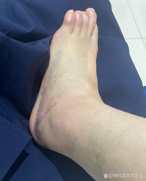 队记：迪恩韦德热身时疑似扭伤了脚踝目前不清楚伤势程度